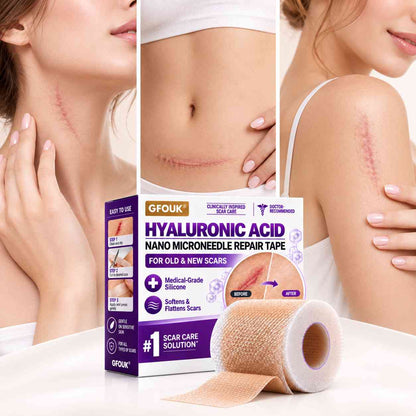 ✅GFOUK® Hyaluronic Acid Nano Microneedle Repair Tape🗽🎁