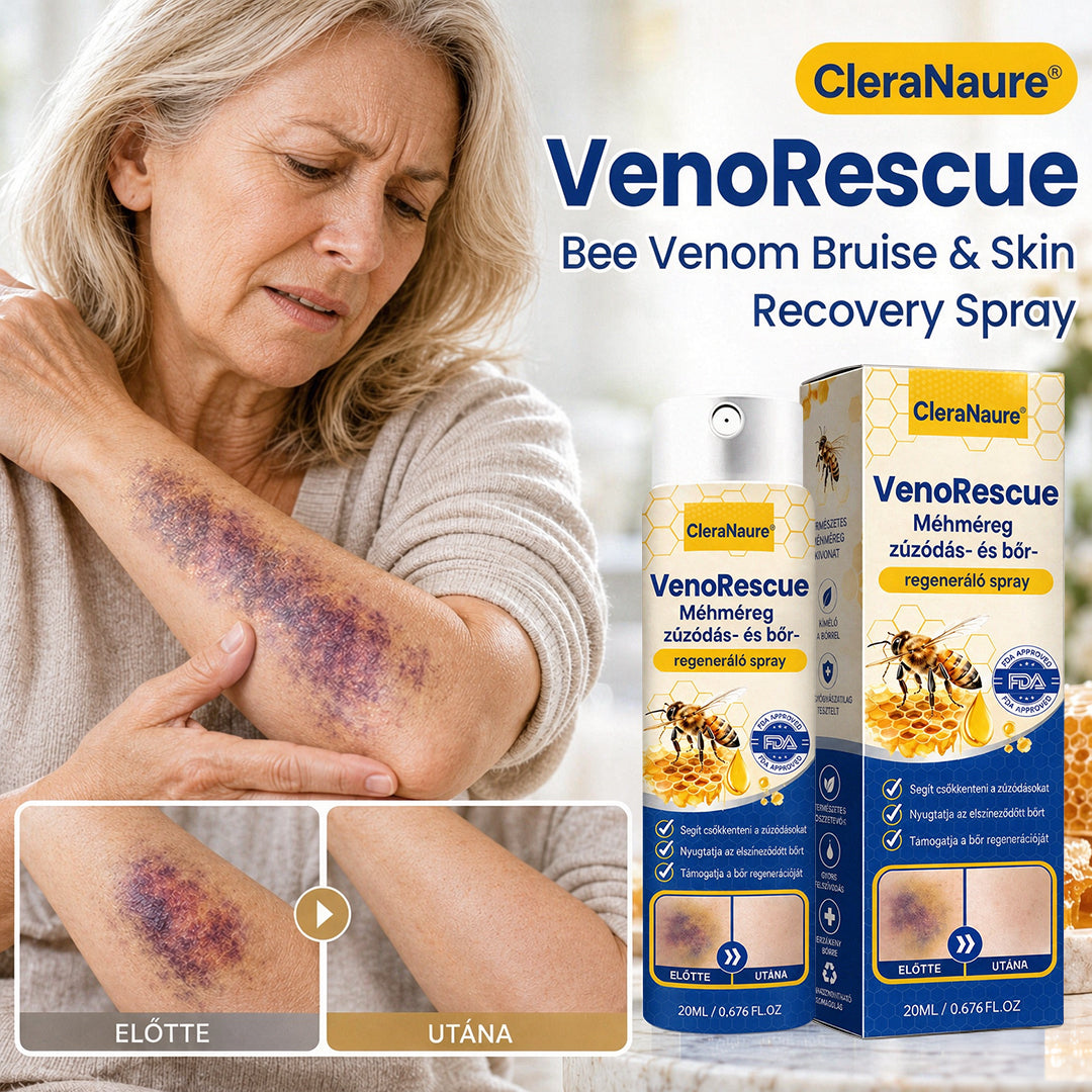 CleraNaure® VenoRescue Méhméreg Zúzódás- és Bőrregeneráló Spray