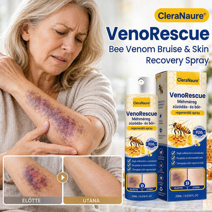 CleraNaure® VenoRescue Méhméreg Zúzódás- és Bőrregeneráló Spray