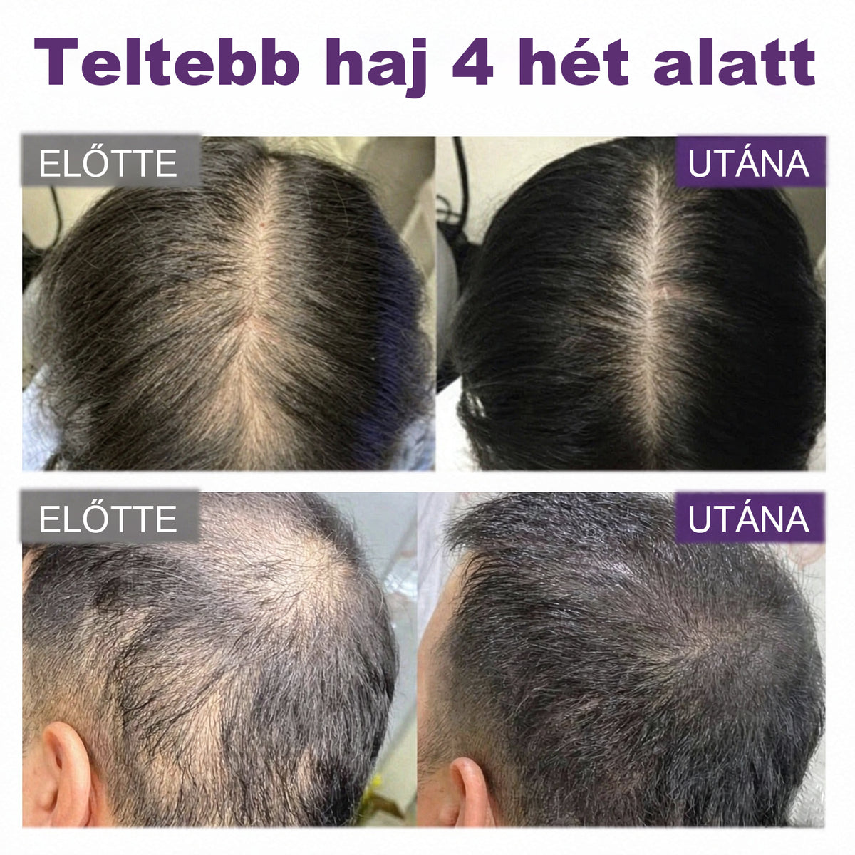 CleraNaure® Fekete rizs és vöröshagyma hajnövekedést támogató spray