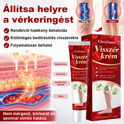 CleraNaure® visszérkezelő krém