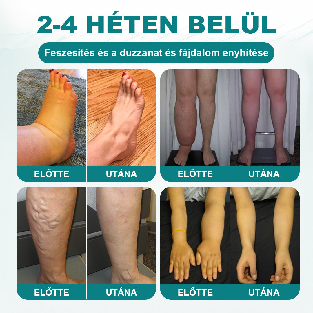 CleraNaure® FluidFlow Lábkeringést Támogató Tapasz