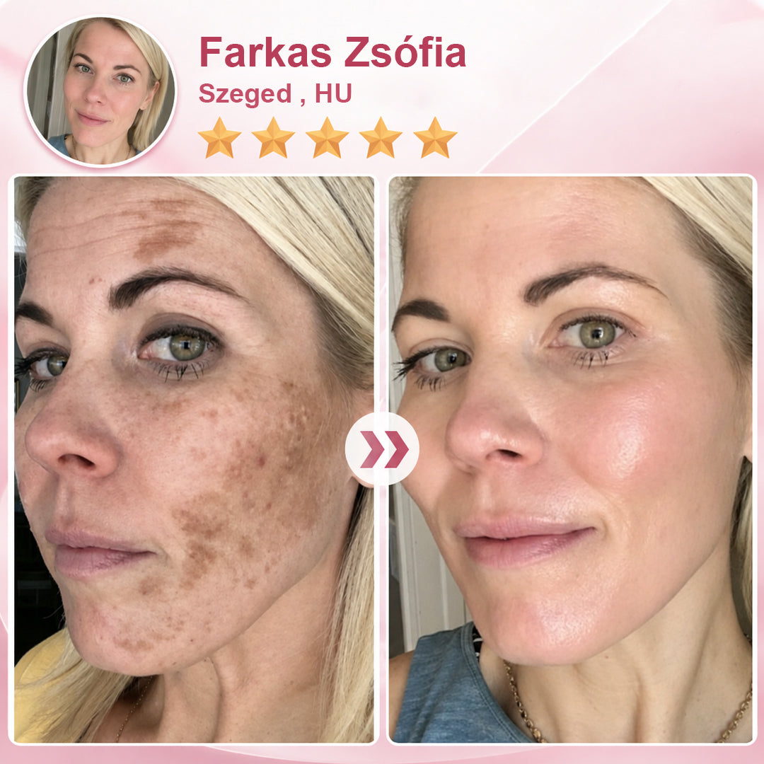 🥇CleraNaure® NADCell Renew – Fejlett NAD+ peptid szérum