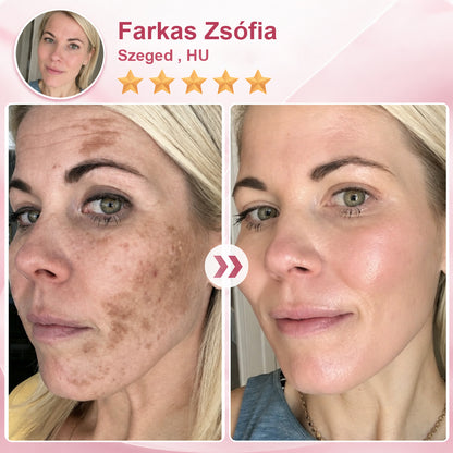 🥇CleraNaure® NADCell Renew – Fejlett NAD+ peptid szérum