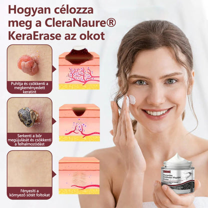 CleraNaure® KeraErase - Kettős hatású bőrfiatalító krém