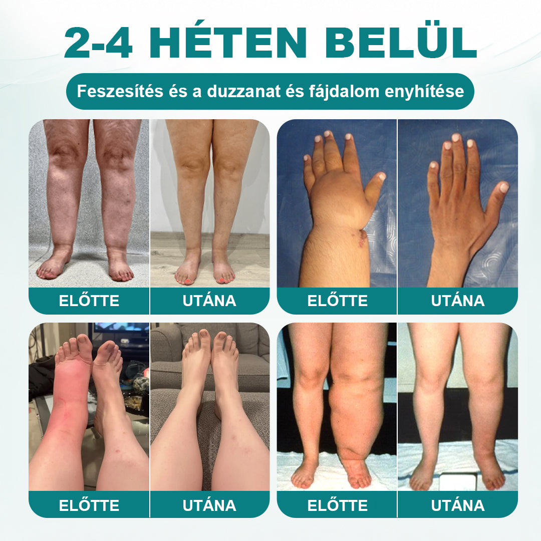 CleraNaure® FluidFlow Lábkeringést Támogató Tapasz