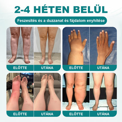 CleraNaure® FluidFlow Lábkeringést Támogató Tapasz