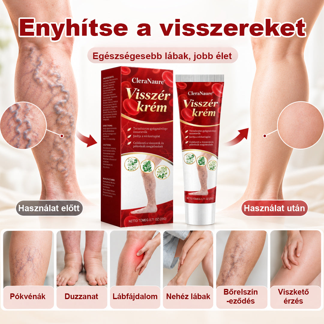 CleraNaure® visszérkezelő krém