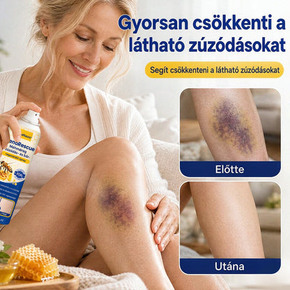 CleraNaure® VenoRescue Méhméreg Zúzódás- és Bőrregeneráló Spray