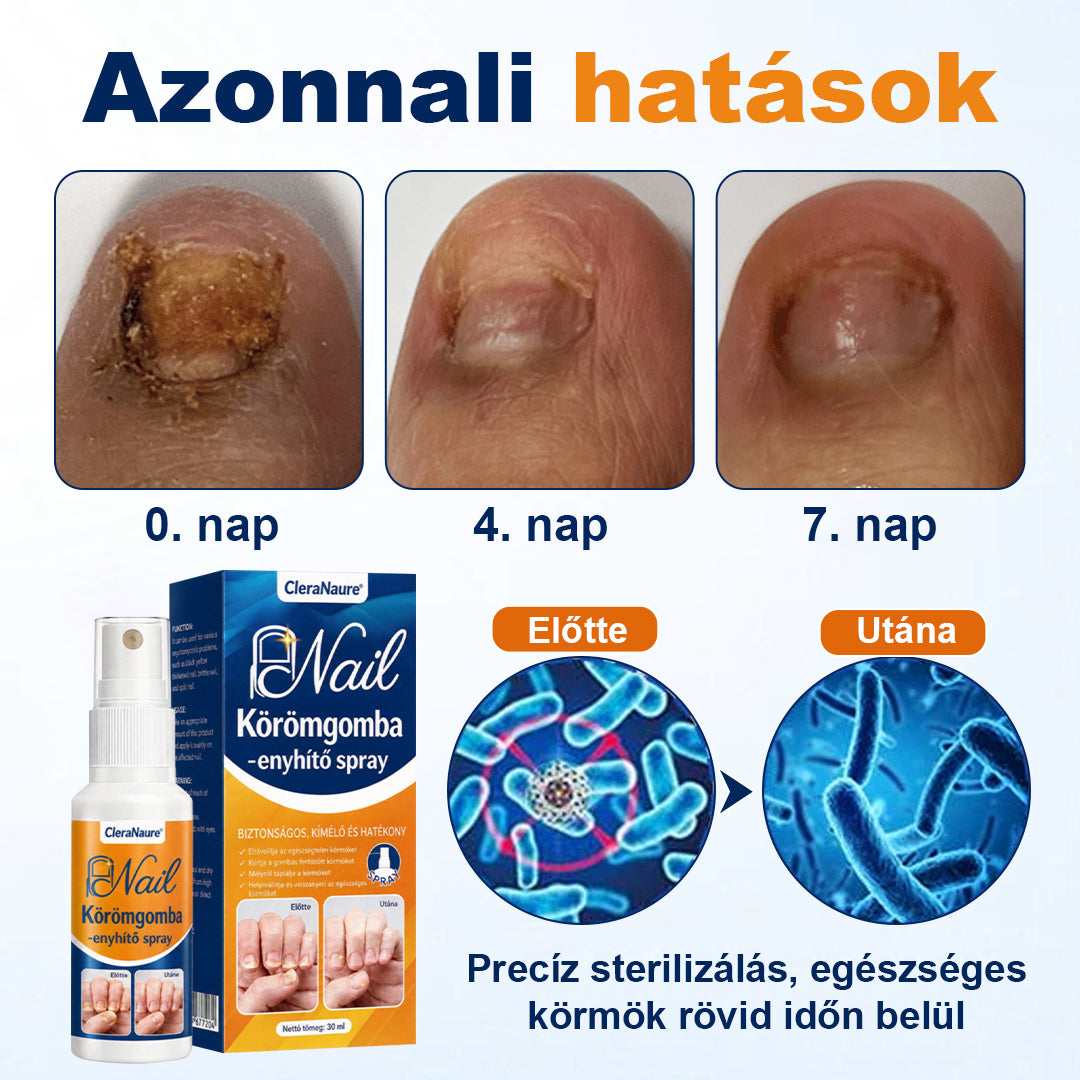 💧CleraNaure® körömgomba-ellenes spray