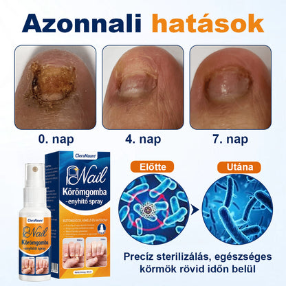 💧CleraNaure® körömgomba-ellenes spray
