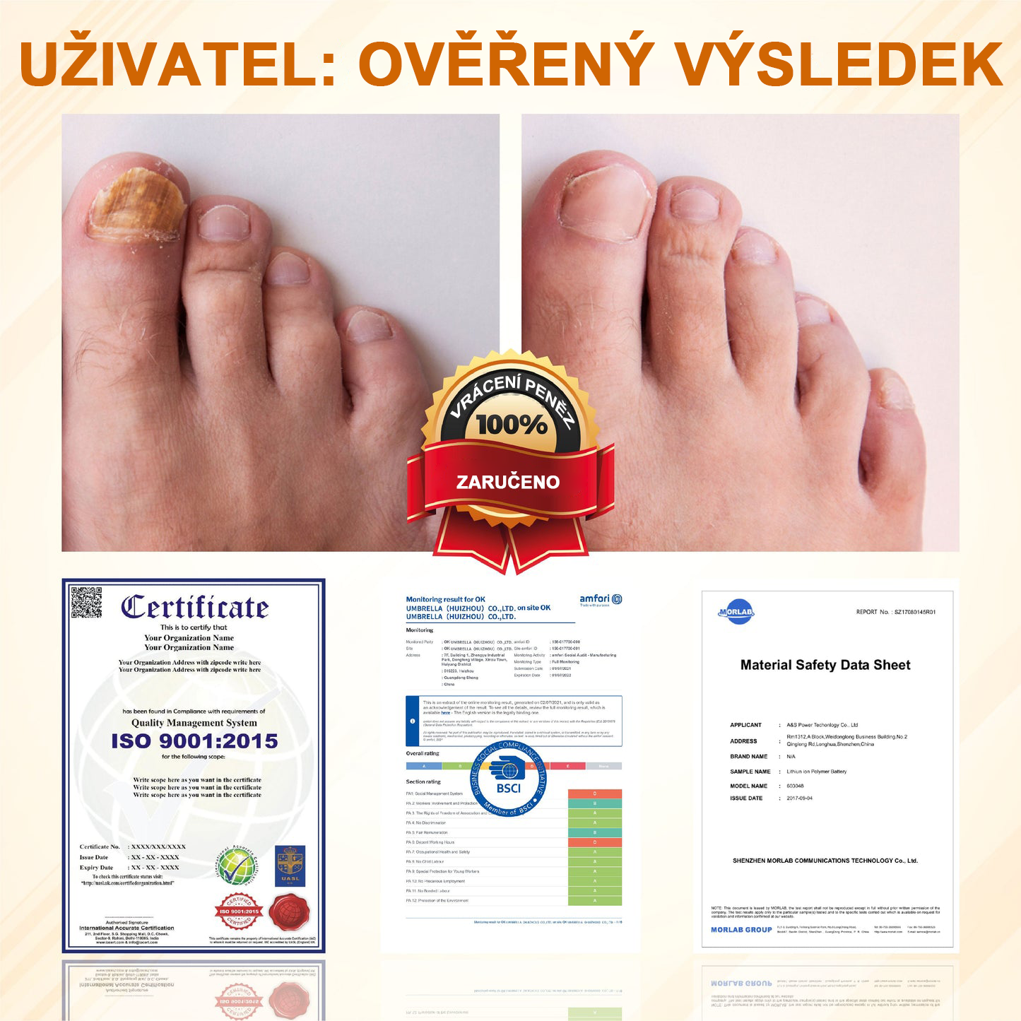 ATTDX® Fungiclear Sprej na nehty s včelí terapií