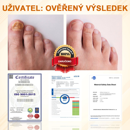 ATTDX® Fungiclear Sprej na nehty s včelí terapií