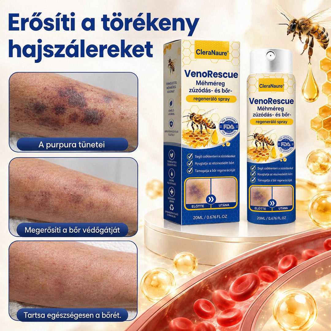 CleraNaure® VenoRescue Méhméreg Zúzódás- és Bőrregeneráló Spray