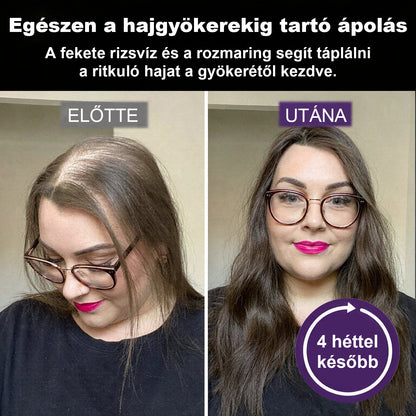 CleraNaure® Fekete rizs és vöröshagyma hajnövekedést támogató spray