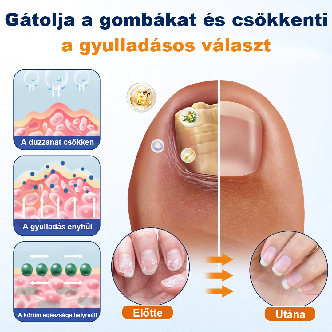 💧CleraNaure® körömgomba-ellenes spray
