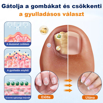 💧CleraNaure® körömgomba-ellenes spray