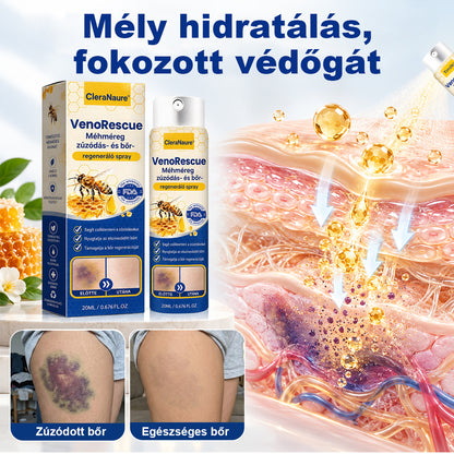 CleraNaure® VenoRescue Méhméreg Zúzódás- és Bőrregeneráló Spray