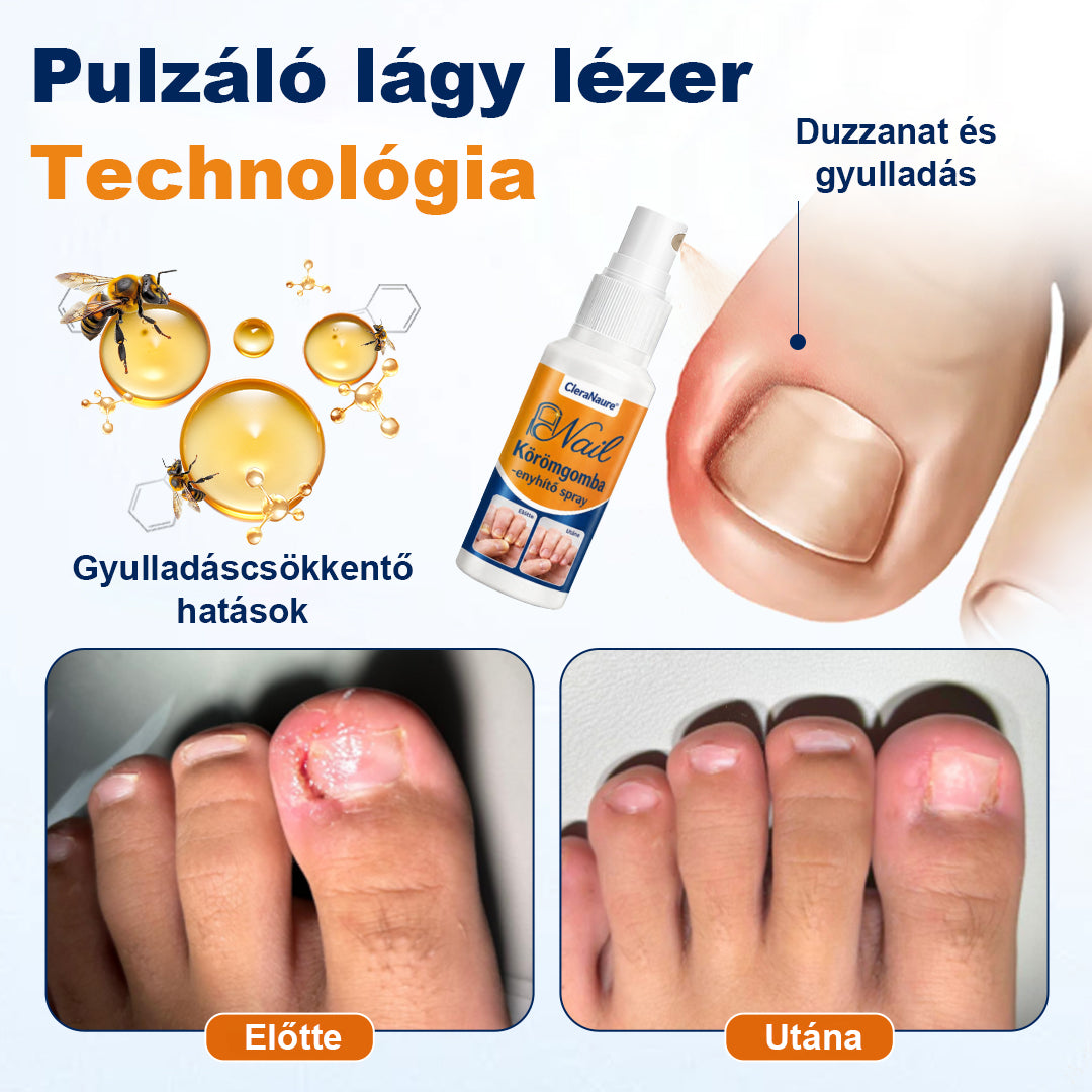 💧CleraNaure® körömgomba-ellenes spray