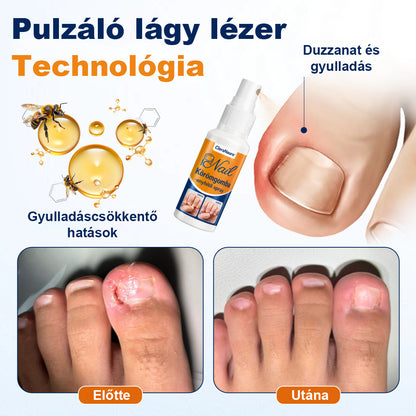 💧CleraNaure® körömgomba-ellenes spray