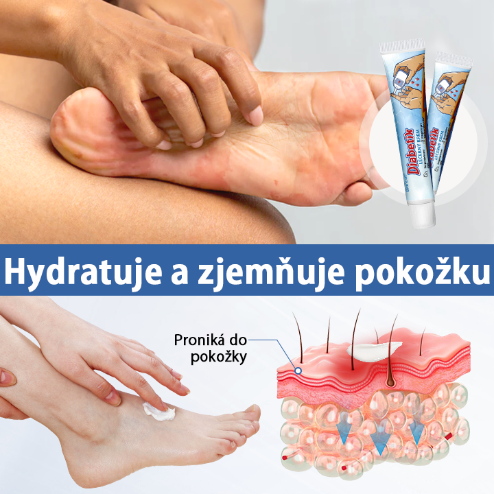 Biancat®✅ VitaGluco krém pro péči o diabetickou nohu