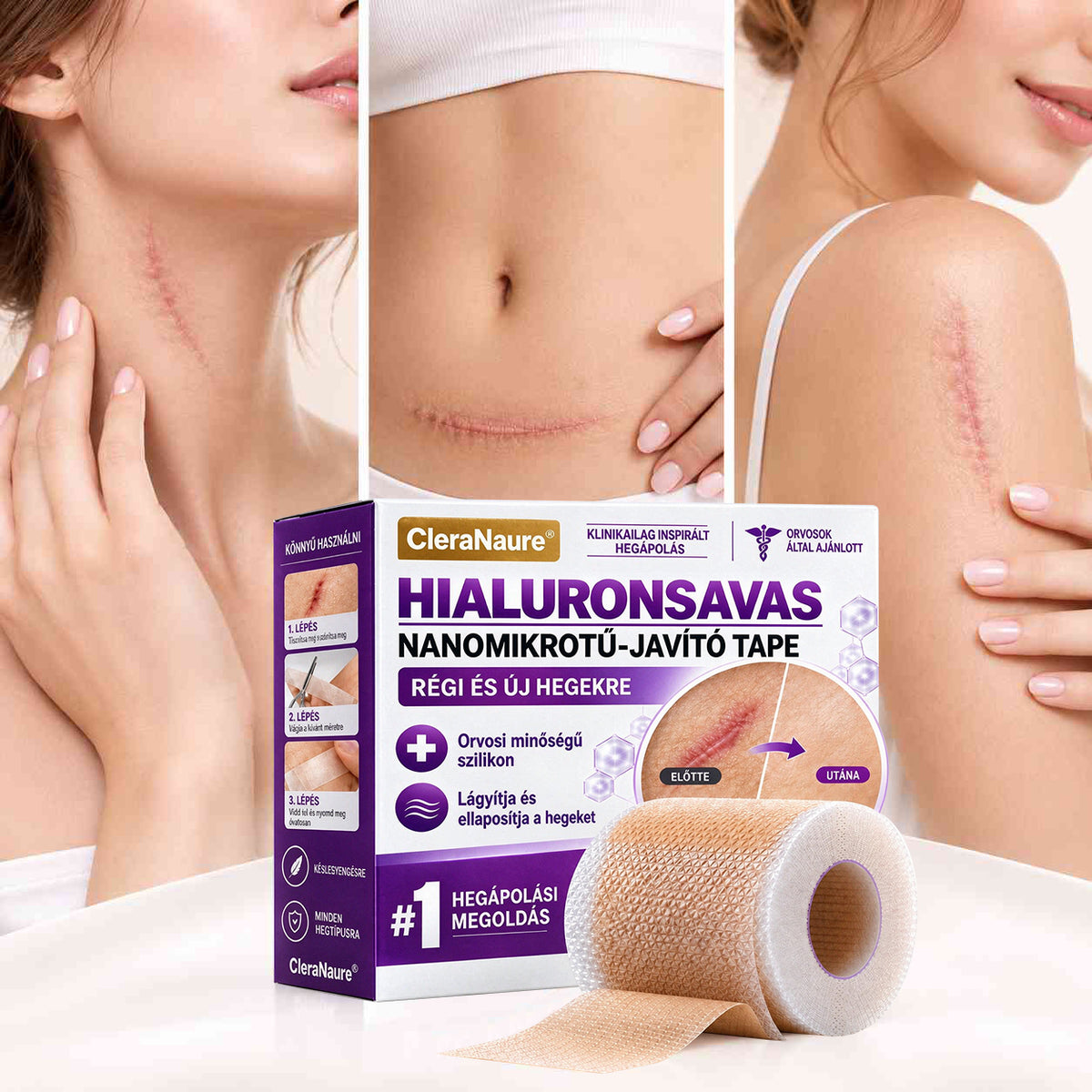 CleraNaure® Hyaluronsavas Nanomikrotű-hegjavító Tapasz