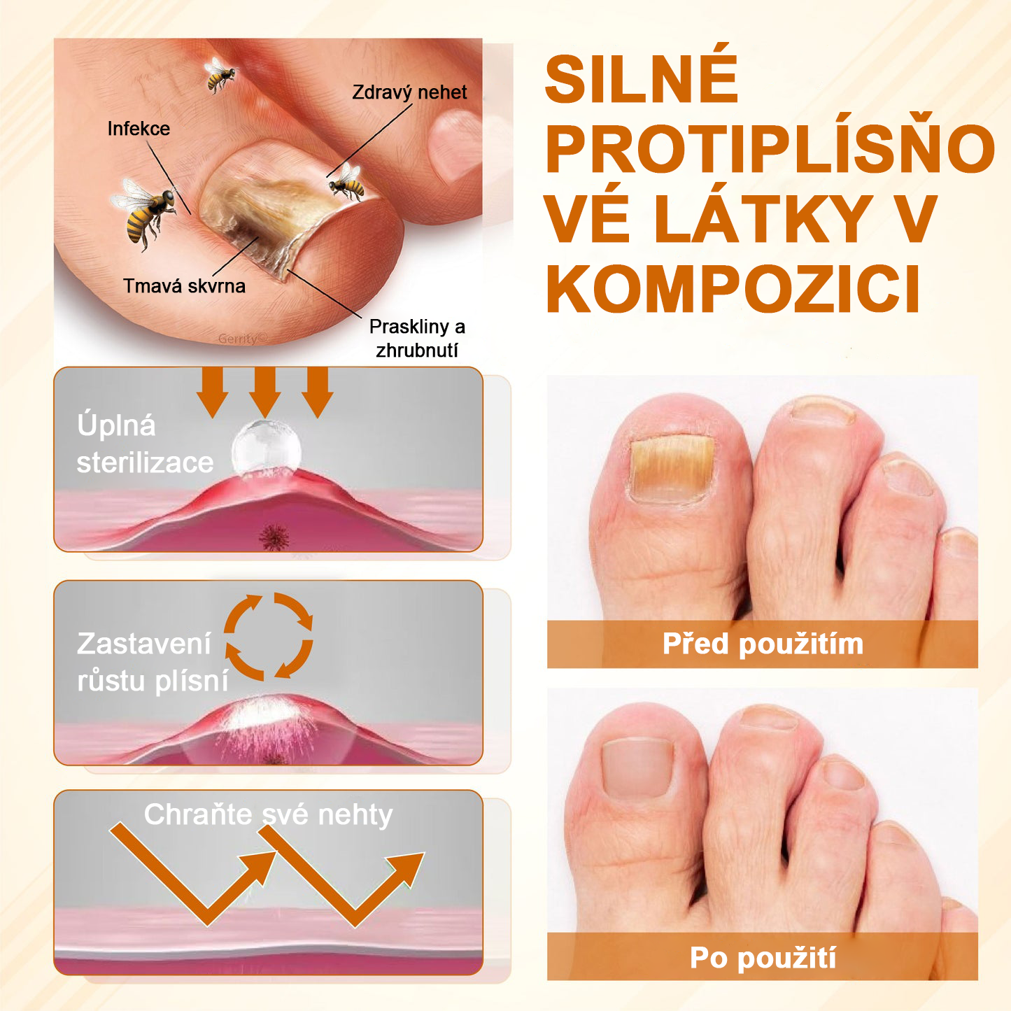 ATTDX® Fungiclear Sprej na nehty s včelí terapií