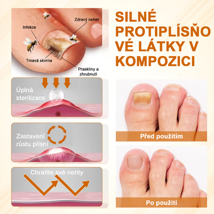 ATTDX® Fungiclear Sprej na nehty s včelí terapií