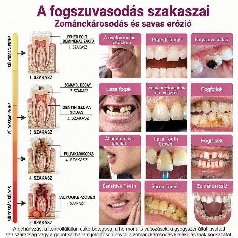 🥇CleraNaure® DenPerm Üregjavító Természetes Zománctömő Gél