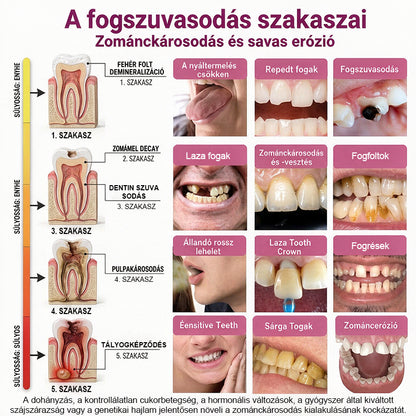 🥇CleraNaure® DenPerm Üregjavító Természetes Zománctömő Gél