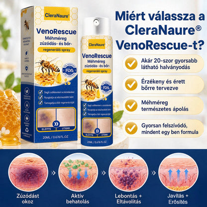CleraNaure® VenoRescue Méhméreg Zúzódás- és Bőrregeneráló Spray