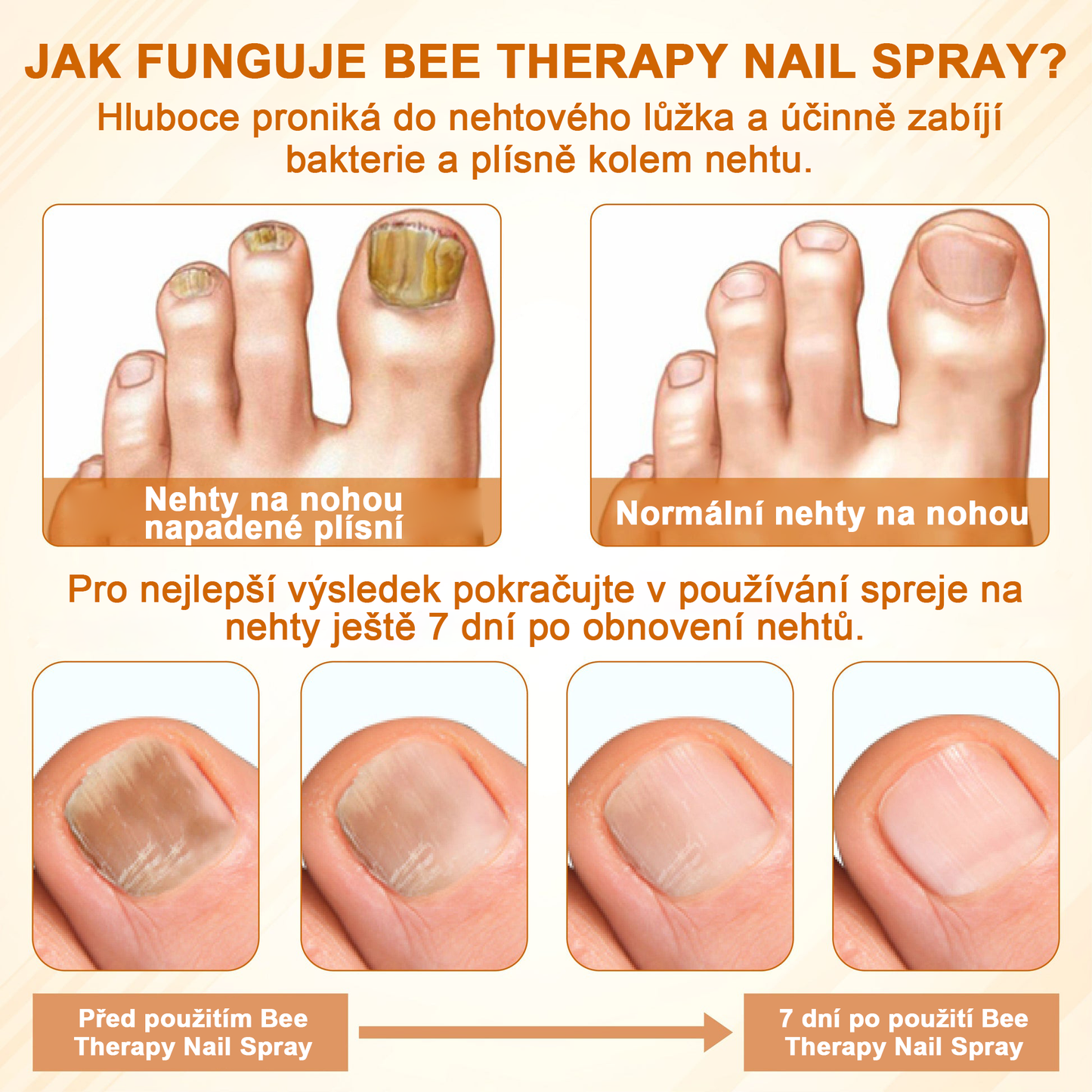 ATTDX® Fungiclear Sprej na nehty s včelí terapií