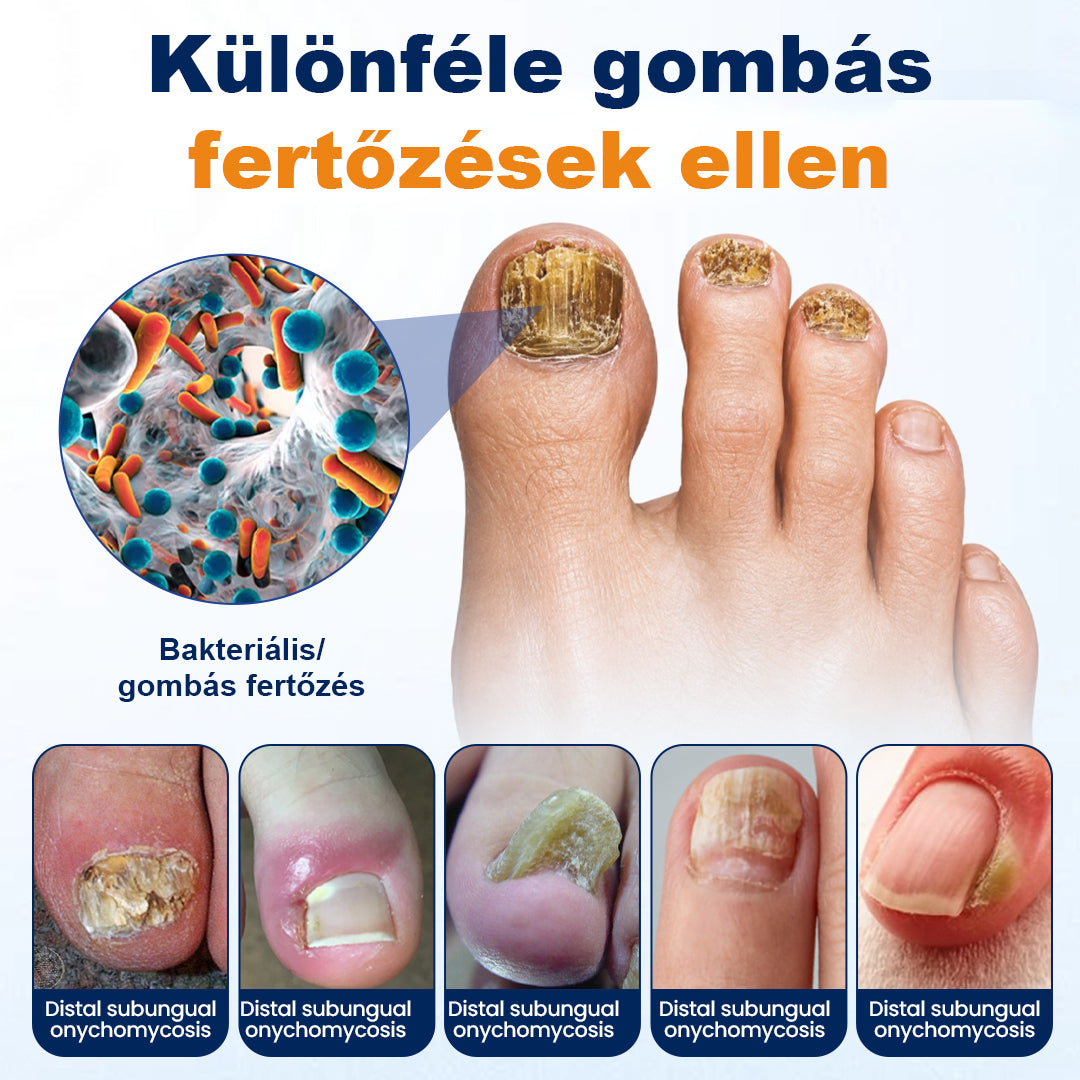 💧CleraNaure® körömgomba-ellenes spray