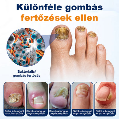 💧CleraNaure® körömgomba-ellenes spray