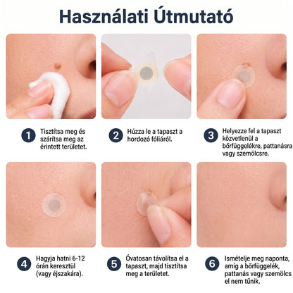 CleraNaure® 2 az 1-ben mikrotűs és hidrokolloid tapasz | Kiálló anyajegyek, aknék, lapos szemölcsök és bőrnövedékek eltávolítására | Segít csökkenteni a ráncokat, hegeket és bőrhibákat | Láthatatlan tapasz az arcra és testre