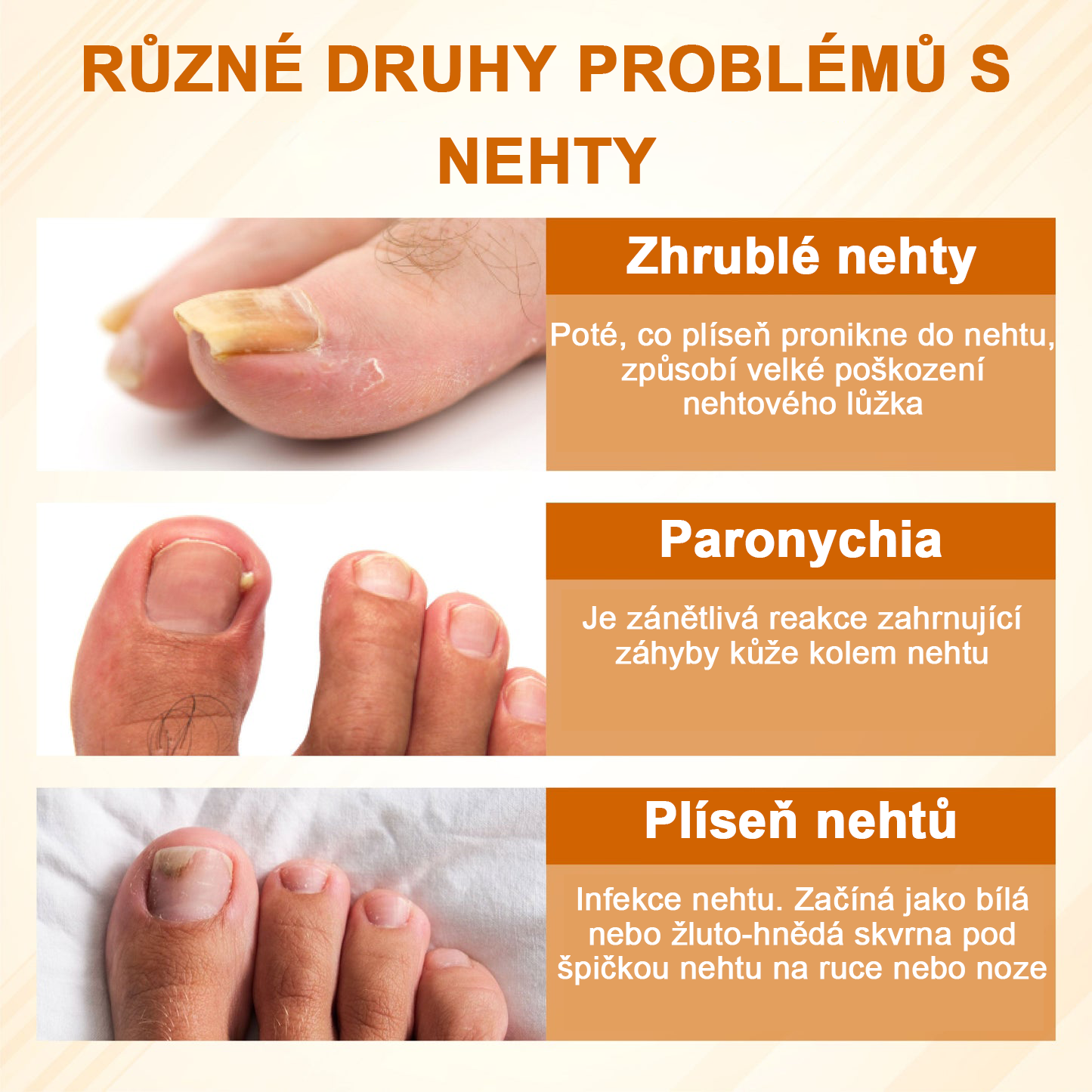 ATTDX® Fungiclear Sprej na nehty s včelí terapií