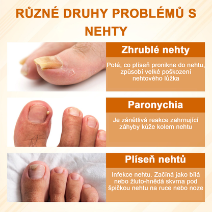 ATTDX® Fungiclear Sprej na nehty s včelí terapií