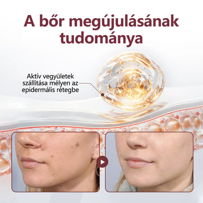 CleraNaure® KeraErase - Kettős hatású bőrfiatalító krém